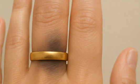 Why Is My Gold Ring Turning My Finger Black?